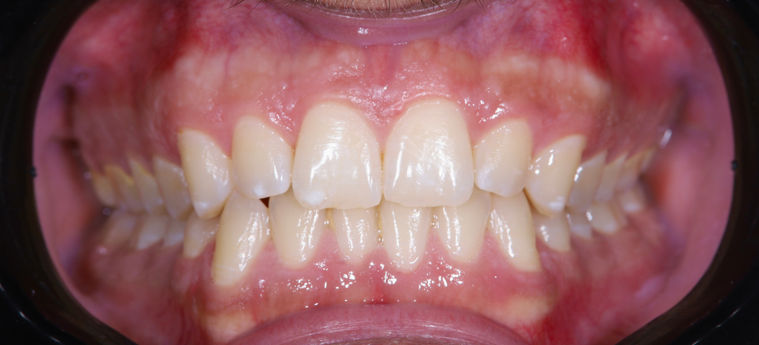 التنظيف والتلميع 2