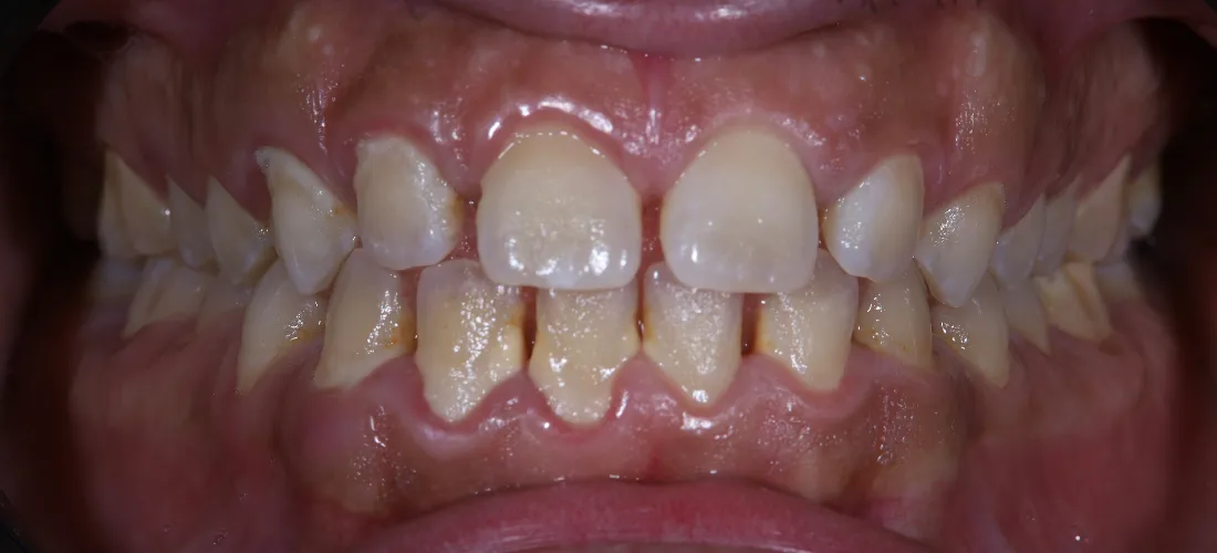 التنظيف والتلميع 1