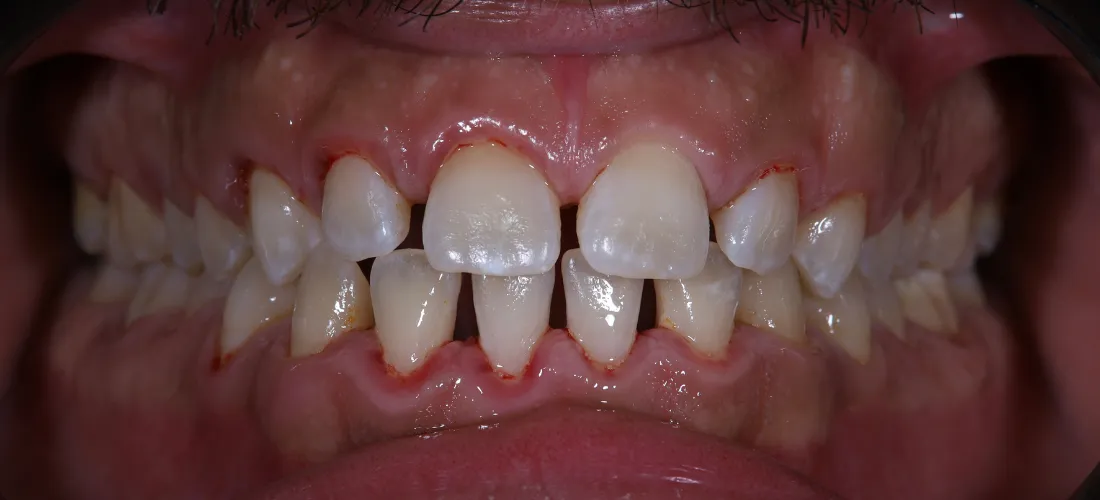 التنظيف والتلميع 1