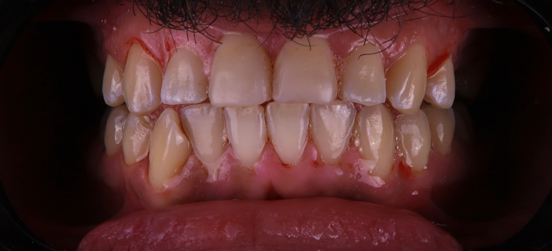 الترميم الجمالي