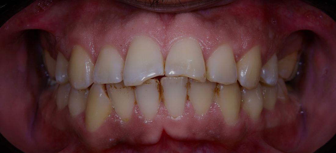 الترميم الجمالي